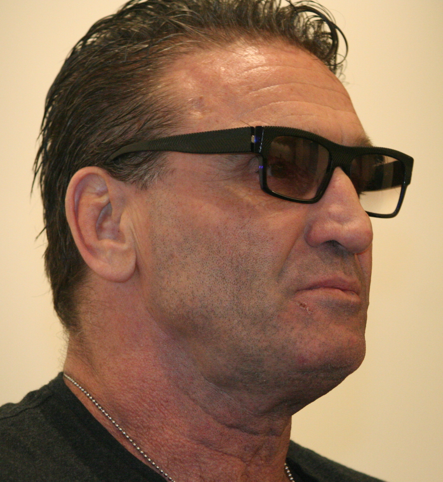 Ken Shamrock Net Worth